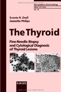 The Thyroid: Fine Needle Biopsy and Cytological Diagnosis of Thyroid Lesions (Monographs in Clinical Cytology) (9783805563833): Svante R. Orell, Jeanette Philips: Books