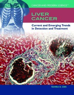Liver Cancer: Current and Emerging Trends in Detection and Treatment (Cancer and Modern Science) (9781435850095): Tamra B. Orr: Books