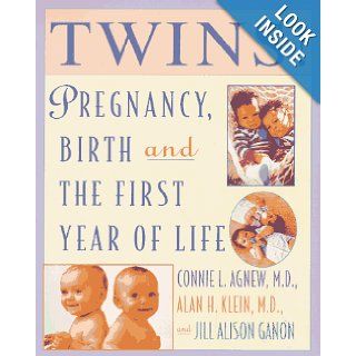 Twins!: Expert Advice from two practicing physicians on pregnancy, birth and the first y: Connie Agnew, Alan Klein: Books