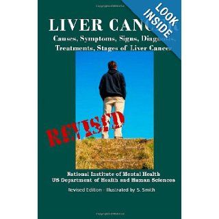 Liver Cancer: Causes, Symptoms, Signs, Diagnosis, Treatments, Stages of Liver Cancer   Revised Edition   Illustrated by S. Smith: Department of Health and Human Services, National Institutes of Health, S. Smith: 9781470019402: Books