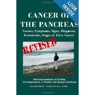 Cancer Of The Pancreas: Causes, Symptoms, Signs, Diagnosis, Treatments, Stages of Pancreatic Cancer: U.S. Department Of Health And Human Services, National Institutes of Health, National Cancer Institute, S. Smith: 9781475010244: Books