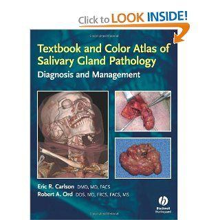Textbook and Color Atlas of Salivary Gland Pathology Diagnosis and Management (9780813802626) Eric Carlson, Robert Ord Books