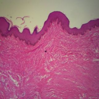Human Heavily Pigmented Skin sec. 7 µm H&E stain Microscope Slide