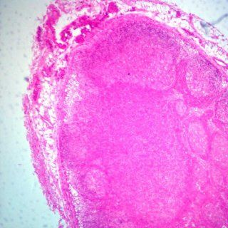 Mammal Lymph Node sec. 7 H&E stain Microscope Slide